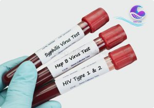 آزمایش خون برای سلامت جنسی - دات لب