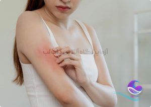 سرطان پوست در بازو - دات لب
