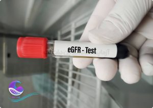 آزمایش تخمین نرخ فیلتراسیون گلومرولی eGFR - دات لب
