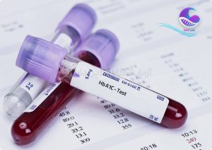 مزایای استفاده از تست A1C در تشخیص دیابت نوع 2 - دات لب