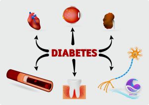کنترل عوارض جانبی دیابت نوع 2 - دات لب